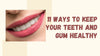 11 Ways To Keep Your Teeth and Gum Healthy